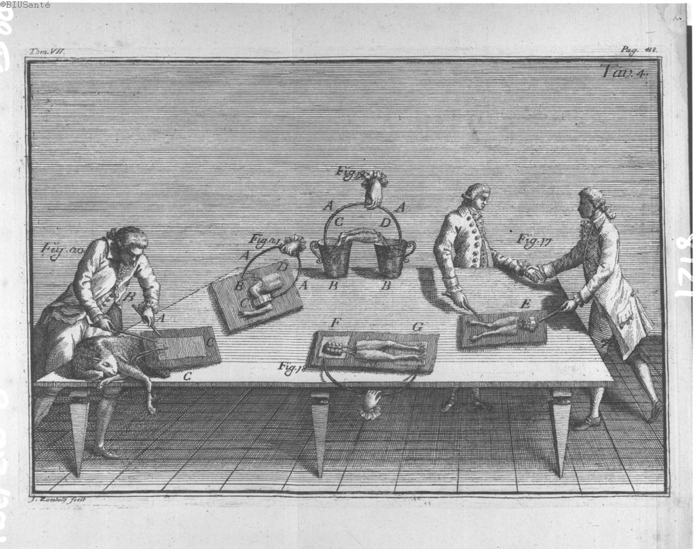 Эксперимент 18 век. Опыты Луиджи Гальвани. Гальвани медицина. 2 Опыт Гальвани.